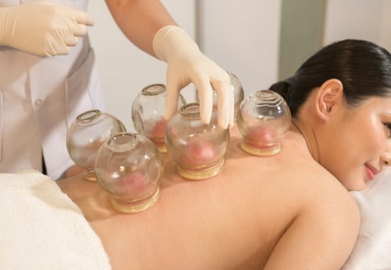 cupping-therapy